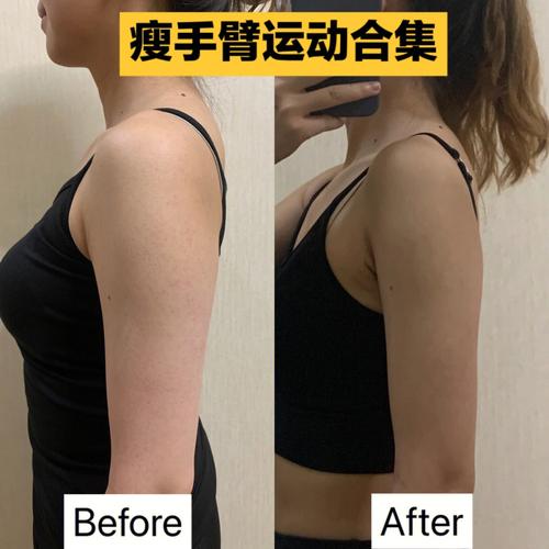怎样瘦胳膊（瘦胳膊方法）