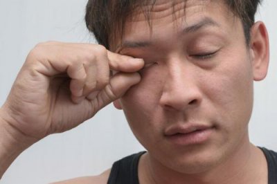 ​黄皮肤药膏是治什么的(黄皮肤药膏的作用与功效)