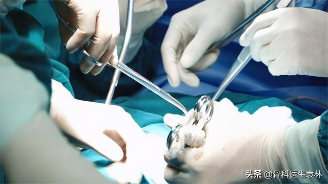 膝骨关节炎治疗方法都有哪几类（膝骨关节病是怎么回事）(6)