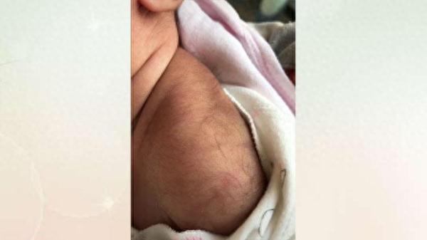后背长毛民间有啥说法(后背长毛是怎么回事)