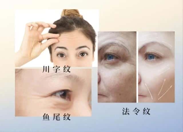 青春定格液怎么使用,安全吗（青春定格原液）