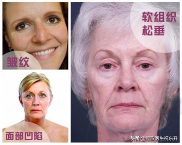 ​玻尿酸适合多大年龄用 听医生聊一聊：不同年龄段的人，做什么医美项目最有效？