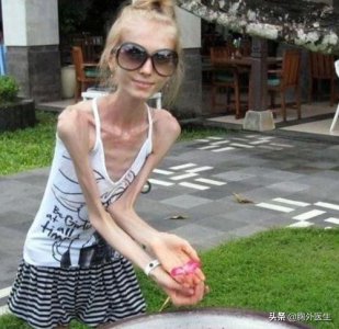​体质指数怎么计算公式（疯狂减肥危害大！人的标准体重是多少？医生教你计算方