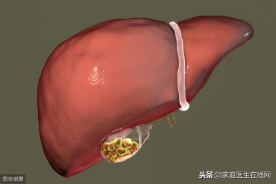 ​胆结石不能吃什么（胆囊长结石的人，这4种食物就别吃了，以免石头越长越大）