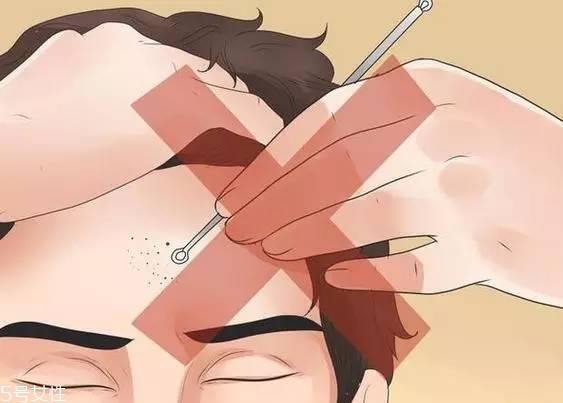 去黑头产品推荐 脸上的黑头就会少很多的小妙招