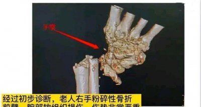 ​又现恶狗伤人事件,请爱狗人士不要集体失声：咬人是狗的本性