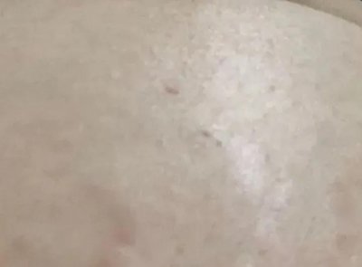 ​怀孕时出现这3个征兆，实则提醒孕妈：要长妊娠纹了