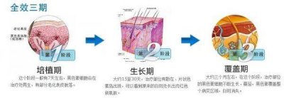 ​令人动容！最后两米马拉松居然用爬——坚持治疗白癜风就是胜利