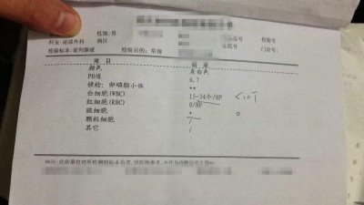 ​如何看懂一张前列腺液的化验单