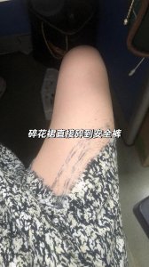 ​女生穿裙子有哪些不方便