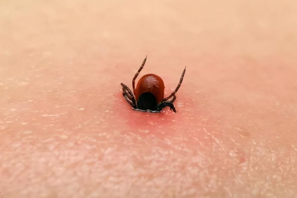房间里发现了蜱虫还能住吗，蜱虫怎么消灭-