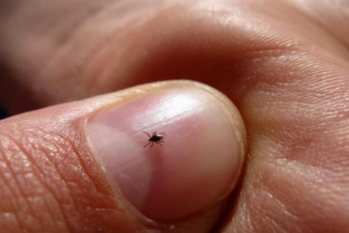 房间里发现了蜱虫还能住吗，蜱虫怎么消灭-