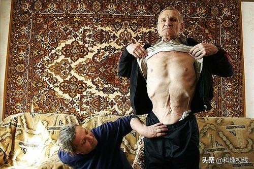 核辐射的后果（核辐射比想象还要可怕）(4)