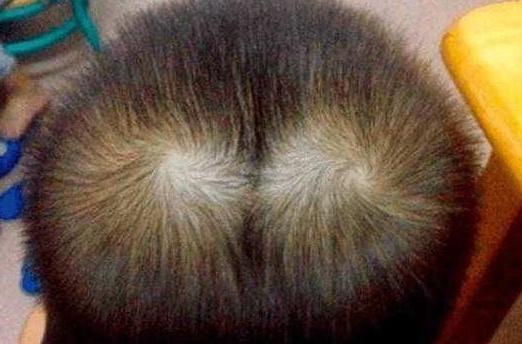 宝宝脑袋上头旋原来是这样形成,你们猜对了吗?!