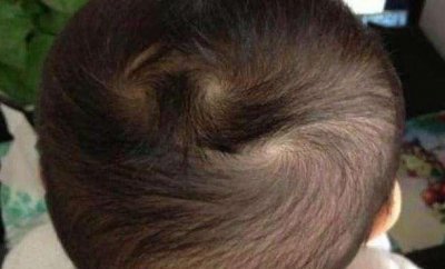 ​宝宝脑袋上头旋原来是这样形成,你们猜对了吗?!