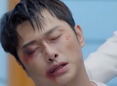 ​朱梓骁这次真的肿了